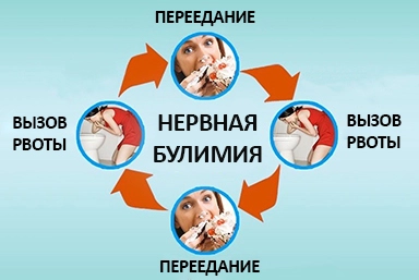 Лечение булимии в Троицком
